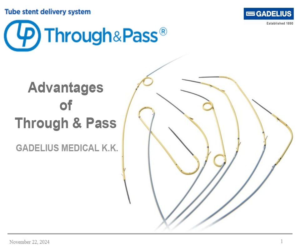 Advantages of Through & Pass