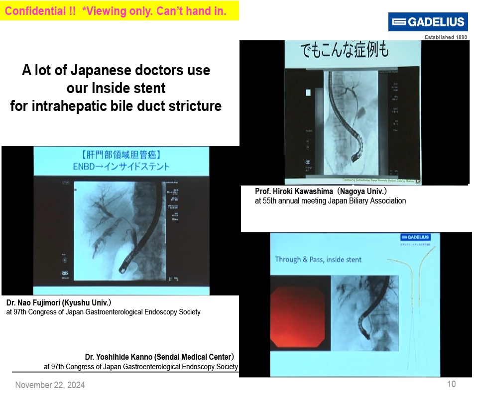 A lot Of Japanese Doctor Uses Inside Stent