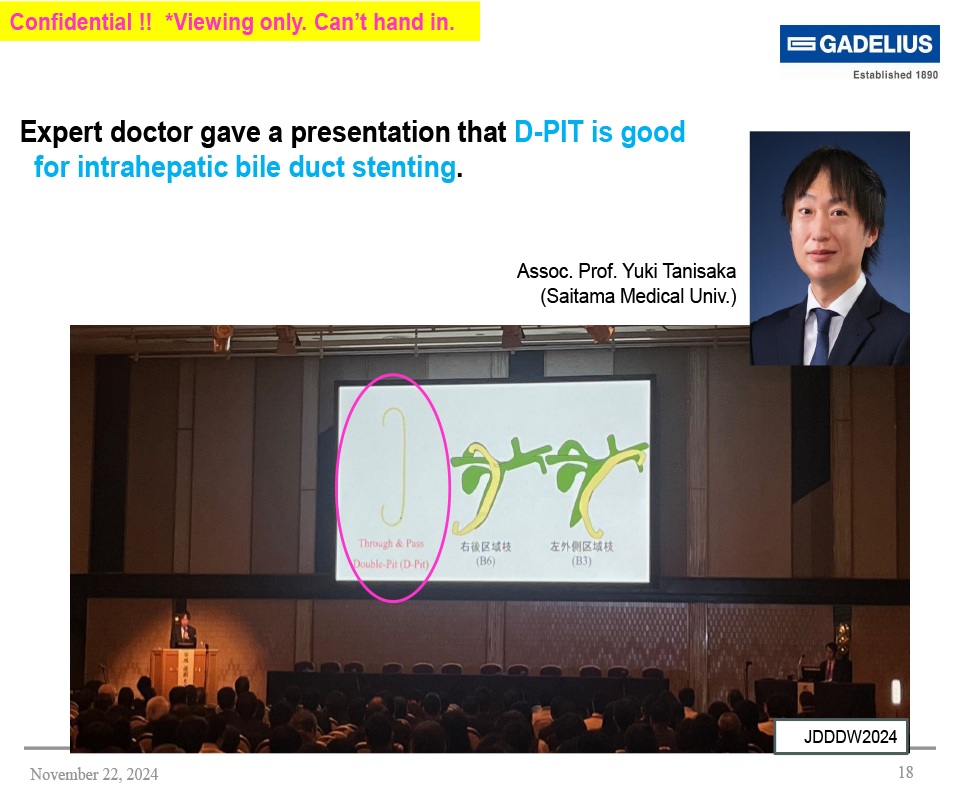 Intrahepatic Bile Duct Stenting