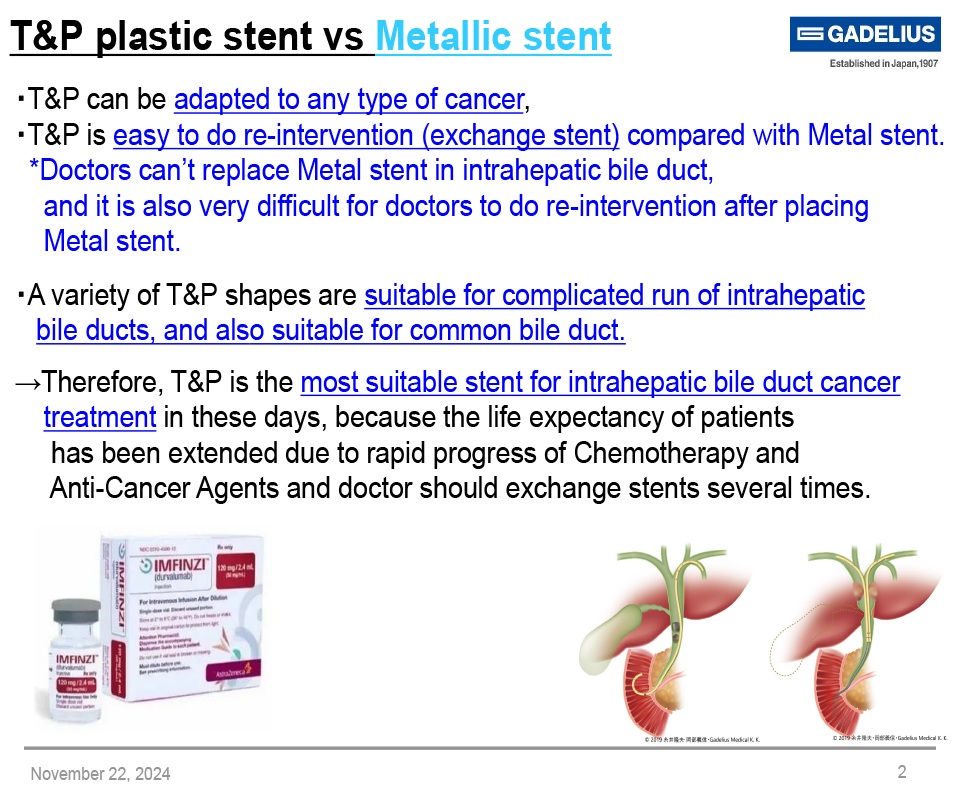 Plastic Stent vs Metallic Stent