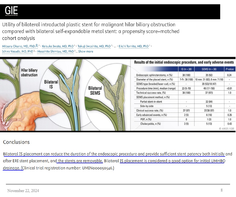 Bilateral Intraductal Plastic Stent