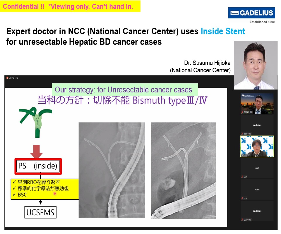 Expert Doctor on Uses of Inside Stent